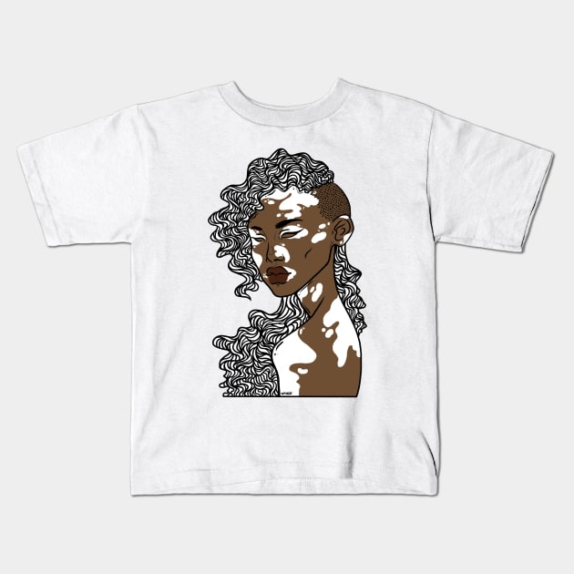 Vitiligo Kids T-Shirt by witskill